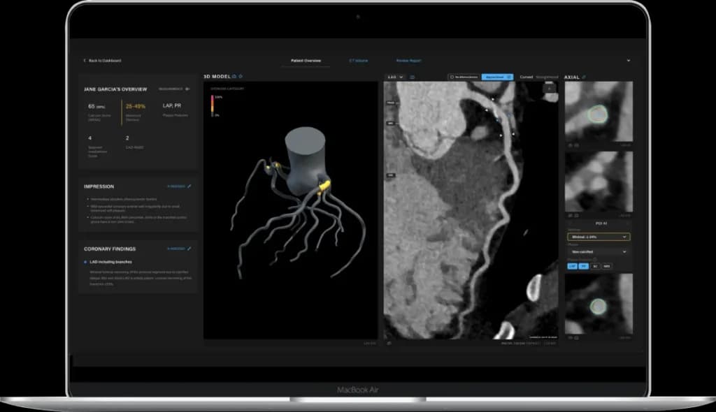Salix screenshot